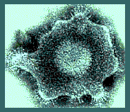 This is an electron micrograph of the Herpes virion showing the internal structures.